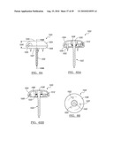 Method and Apparatus for Surgical Navigation diagram and image