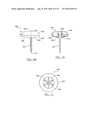 Method and Apparatus for Surgical Navigation diagram and image