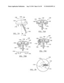 Method and Apparatus for Surgical Navigation diagram and image