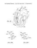 Method and Apparatus for Surgical Navigation diagram and image