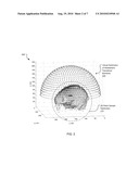 CT-Guided Focused Ultrasound for Stroke Treatment diagram and image