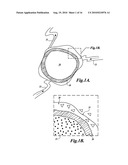 METHOD AND APPARATUS FOR TREATING TISSUES WITH HIFU diagram and image