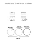 METHOD AND APPARATUS FOR TREATING TISSUES WITH HIFU diagram and image