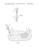 SYSTEMS AND METHODS FOR TREATING SUPERFICIAL VENOUS MALFORMATIONS LIKE SPIDER VEINS diagram and image