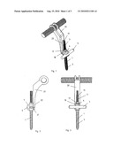 APPARATUS FOR SPINAL-COLUMN STABILIZATION diagram and image