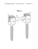 Telescopic Rod For Posterior Dynamic Stabilization diagram and image