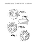 Polyaxial bone anchor with shelf capture connection diagram and image