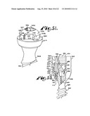 Polyaxial bone anchor with shelf capture connection diagram and image