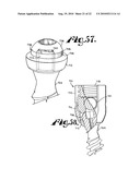 Polyaxial bone anchor with shelf capture connection diagram and image