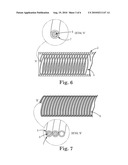 ELECTRICALLY CONDUCTING MATERIALS, LEADS, AND CABLES FOR STIMULATION ELECTRODES diagram and image