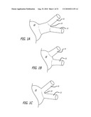 Electrical Conduction Block Implant Device diagram and image