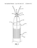 Electrical Conduction Block Implant Device diagram and image