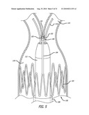 Electrical Conduction Block Implant Device diagram and image