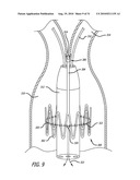 Electrical Conduction Block Implant Device diagram and image