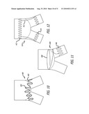 Electrical Conduction Block Implant Device diagram and image