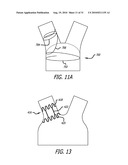 Electrical Conduction Block Implant Device diagram and image