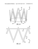 Electrical Conduction Block Implant Device diagram and image