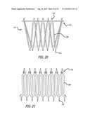 Electrical Conduction Block Implant Device diagram and image