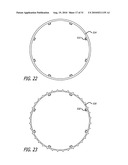 Electrical Conduction Block Implant Device diagram and image