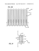 Electrical Conduction Block Implant Device diagram and image