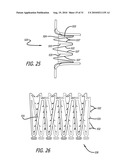 Electrical Conduction Block Implant Device diagram and image