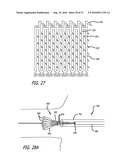 Electrical Conduction Block Implant Device diagram and image