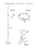 Electrical Conduction Block Implant Device diagram and image