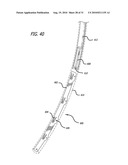 Electrical Conduction Block Implant Device diagram and image