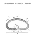 ACTIVELY-ENGAGEABLE MOVEMENT-RESTRICTION MECHANISM FOR USE WITH AN ANNULOPLASTY STRUCTURE diagram and image