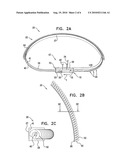 ACTIVELY-ENGAGEABLE MOVEMENT-RESTRICTION MECHANISM FOR USE WITH AN ANNULOPLASTY STRUCTURE diagram and image