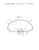 ACTIVELY-ENGAGEABLE MOVEMENT-RESTRICTION MECHANISM FOR USE WITH AN ANNULOPLASTY STRUCTURE diagram and image