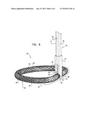 ACTIVELY-ENGAGEABLE MOVEMENT-RESTRICTION MECHANISM FOR USE WITH AN ANNULOPLASTY STRUCTURE diagram and image