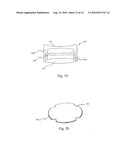 MULTI-FOCAL PROSTHESIS, AND METHODS FOR MAKING AND USING SAME diagram and image