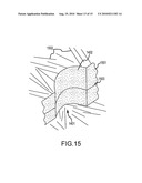 Chemical Mechanical Vapor Deposition Device for Production of Bone Substitute Material diagram and image