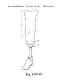ATTACHMENT STRAP FOR TRANS-TIBAL PROSTHETICS diagram and image
