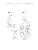 WALL HANGER diagram and image