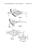 Fibre optic probe diagram and image