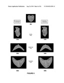 Object Model Fitting Using Manifold Constraints diagram and image