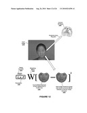 Object Model Fitting Using Manifold Constraints diagram and image