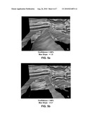 METHOD AND APPARATUS FOR DYNAMIC EXTRACTION OF EXTREMA-BASED GEOMETRIC PRIMITIVES IN 3D VOXEL VOLUMES diagram and image