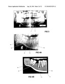 METHOD FOR INDICATING A CHARACTERISTIC OF BONE MINERAL DENSITY diagram and image