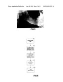 METHOD FOR INDICATING A CHARACTERISTIC OF BONE MINERAL DENSITY diagram and image