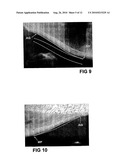 METHOD FOR INDICATING A CHARACTERISTIC OF BONE MINERAL DENSITY diagram and image