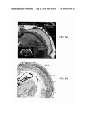 METHOD AND SYSTEM FOR CHARACTERIZING CORTICAL STRUCTURES diagram and image