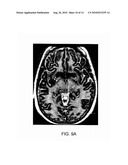 METHOD AND SYSTEM FOR CHARACTERIZING CORTICAL STRUCTURES diagram and image