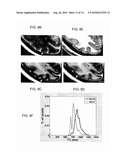 METHOD AND SYSTEM FOR CHARACTERIZING CORTICAL STRUCTURES diagram and image