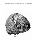 METHOD AND SYSTEM FOR CHARACTERIZING CORTICAL STRUCTURES diagram and image