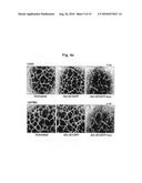 Recombinant Adenoviruses Capable Of Regulating Angiogenesis diagram and image