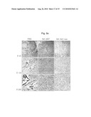 Recombinant Adenoviruses Capable Of Regulating Angiogenesis diagram and image