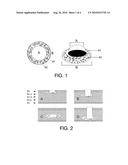 IMPLANTABLE OPTICAL SYSTEM, METHOD FOR DEVELOPING IT AND APPLICATIONS diagram and image